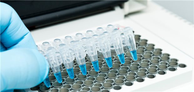 Vorbereitung auf eine PCR: Zur Diagnosefindung sollte die Untersuchung des Gelenkpunktats auch eine PCR auf Tropheryma whipplei einschließen. 