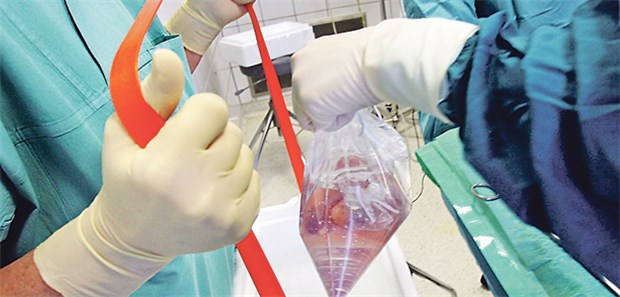 Zu viele scharfe Skalpelle Vorbereitung einer Nierentransplantation: .Auf der Warteliste in Deutschland stehen mehr als 7900 Patienten.
