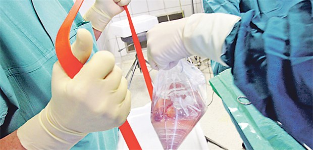 Organvergabe sollte überdacht werden Vorbereitung einer Nierentransplantation: In anderen Ländern werden Erfolgsaussichten stärker berücksichtigt.