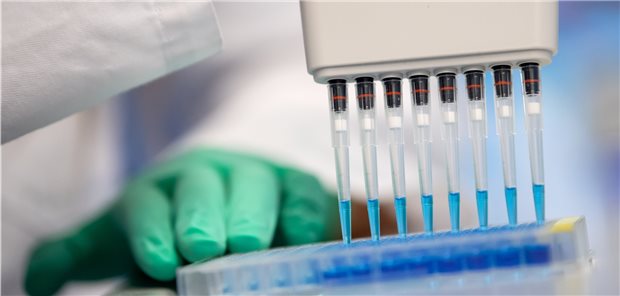 Vorbereitung für den ELISA-Test: Auf SARS-CoV-2-Antikörper dürfte bald häufiger getestet werden.