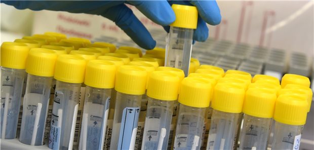 Expertengruppe: Es ist Zeit, „mit Corona leben zu lernen“ Vorbereitung von PCR-Tests in einem Automaten: Spätestens seit der Ausbreitung der Omikron-Variante geht von den vom RKI veröffentlichten Zahlen keinerlei Steuerungswirkung mehr aus, heißt es in der Stellungnahme einer Gruppe von Fachleuten.