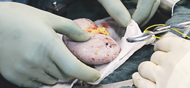 Eine Erfolgsstory Vorbereitung zur Nierentransplantation.