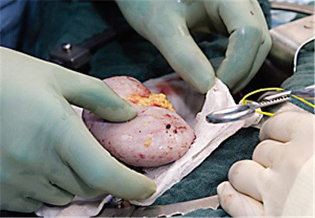 Ermutigendes zu Immuntoleranz gegenüber Spenderorganen Vorbereitung zur Nierentransplantation.