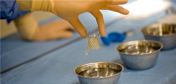 Vorbereitung zum katheterbasierten Aortenklappenersatz (TAVI). 