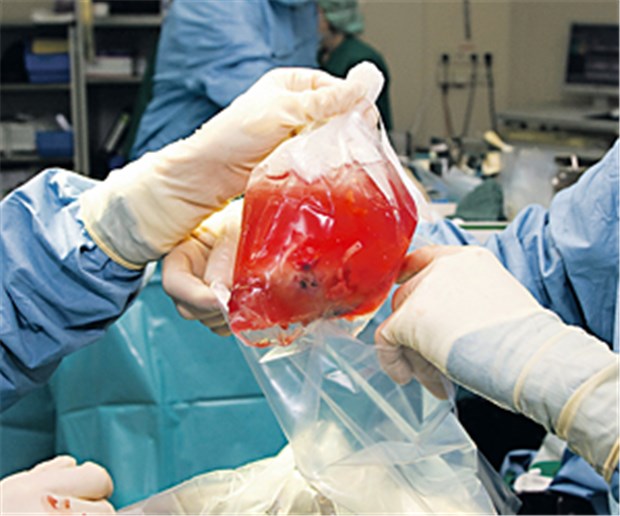 Alle Hoffnung ruht auf der Entscheidungslösung Vorbereitungen für eine Nierentransplantation. Zur Zeit gibt es in Deutschland immer noch viel zu wenig Spenderorgane.