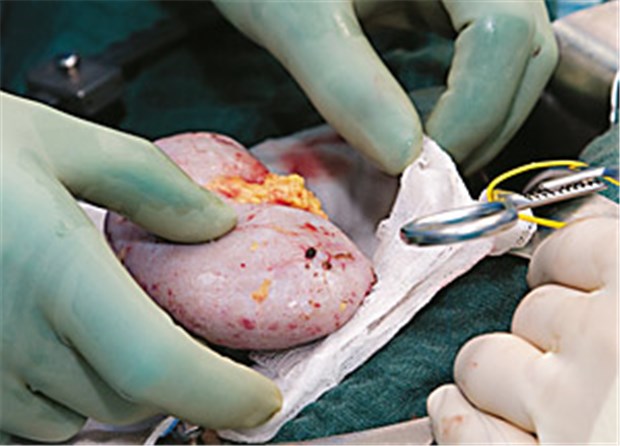Neue Wege aus dem Organmangel - in der BRD nur nach Gesetzesänderungen Vorbereitungen im Op für die Transplantation einer Spenderniere.