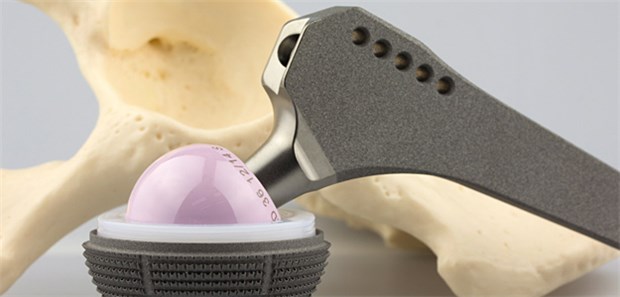 Branche plant Qualitätsoffensive Vorbild Endoprothese: Der Industrieverband BVMed sieht die Zusammenarbeit mit Kassen und Fachgesellschaft in Sachen Endoprothesenregister als mögliche Blaupause für weitere Innovationen der Branche an.