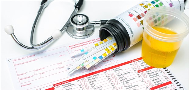 Vordiagnostik per Mehrparameter-Harnteststreifen - sie dient als Ausgangspunkt für die weiterführende Diagnostik mit mikroskopischen, bakteriologischen oder klinisch-chemischen Analysen des Urins.