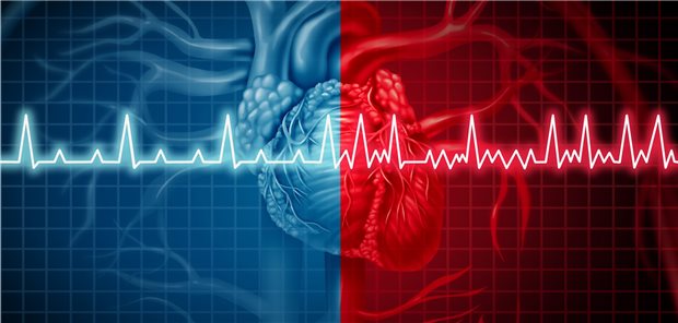 Vorhofflimmern: Begründet wurde der Wunsch der Patienten nach Beendigung der Antikoagulation vor allem mit den als lästig empfundenen Umständen der Therapie.