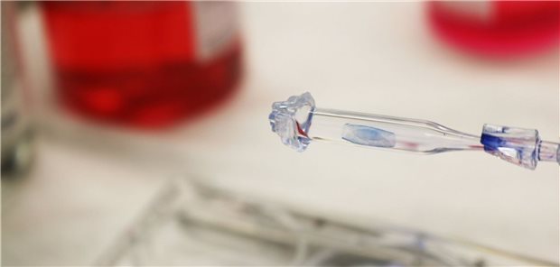 Vorpräparierte humane Hornhauttransplantate für DMEK-Transplantationen dienen der Wiederherstellung der Sehkraft nach Hornhauttrübung.