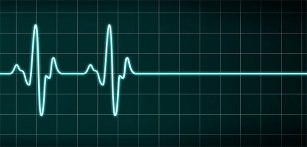 BÄK verschärft Regeln für Hirntod-Diagnostik Wann ist hirntot wirklich tot? Diese Frage ist nicht leicht zu beantworten. Künftig sollen strengere Regeln gelten.