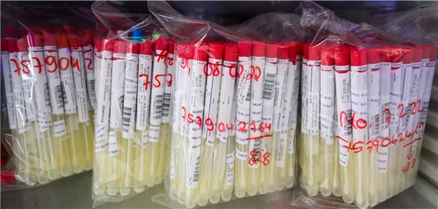 PCR-Tests von Patienten liegen im Labor in einem Kühlschrank.