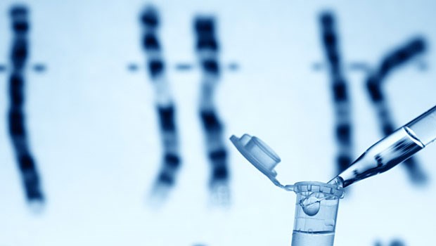 Melanom-Risiko - ein Fall für personalisierte Medizin? Was bringt Gendiagnostik, zum Beispiel beim Melanom-Risiko? Gefahren könnten Überdiagnostik und Übertherapie sein.