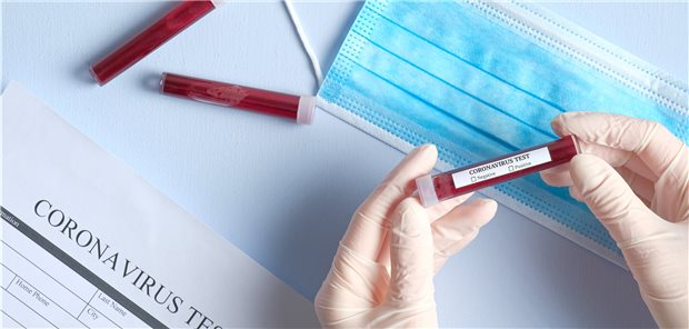 Experten provozieren mit konstruktiver Corona-Kritik Was kann man besser machen und was hätte man schon jetzt besser machen können? Sechs Experten aus Lehre und Gesundheitswesen haben ihre Gedanken zum aktuellen Geschehen rund um die Bekämpfung des Coronavirus in einem Thesenpapier zusammengefasst.