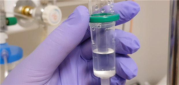 Was kommt in die Infusion? Auch für Patienten mit Multiplem Myelom wird die Forschung zu neuen Therapieoptionen vorangetrieben.