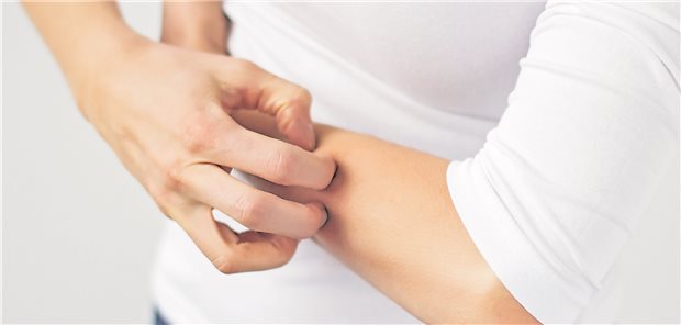 Dermatologen setzen bei Neurodermitis-Patienten auf Schulungen Was tun, wenn es juckt? Die Schulungsprogramme ARNE und AGNES liefern Betroffenen und Angehörigen Tipps zum Umgang mit Neurodermitis.