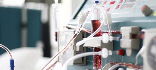 DGfN stellt Indikation klar Waschmaschine für's Blut: In Aurich unnötig eingesetzt?