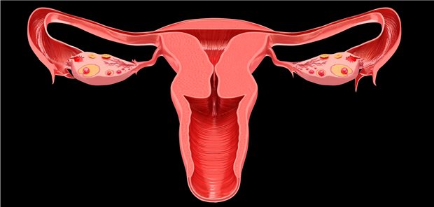 Weiblicher Genitaltrakt: Bei zu langen und zu heftigen Menstruationsblutungen mindert die Hochfrequenzablation des Endometriums mit Netzelektrode nicht nur die Stärke der Blutungen, sondern auch damit einhergehende Regelschmerzen.
