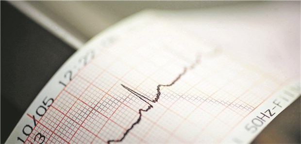 Seltsames Phänomen Welche Konsequenz hat das Ekg?