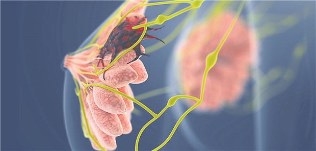 Welche Rolle spielt der Fettanteil bei der täglichen Ernährung für die Entstehung von Brustkrebs?