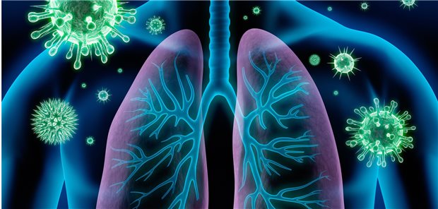 Welcher Erreger liegt einer Pneumonie zugrunde? Vor SARS-CoV-2 waren die häufigsten nachgewiesenen Pathogene humane Rhinoviren, Influenza-A- oder -B-Viren und Streptococcus pneumoniae.