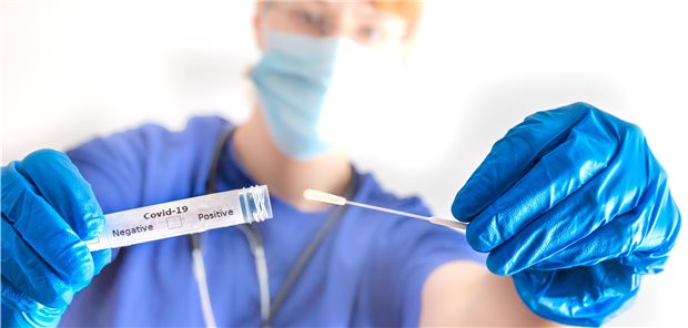 So soll in der EU auf SARS-CoV-2 getestet werden Welcher Patient soll getestet werden, ob er an COVID-19 erkrankt ist – und welcher nicht? Die EU hat das jetzt festgelegt.