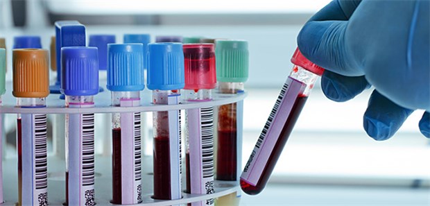 Weniger Tests auf HBV und HCV – obwohl der HCV-Antikörper-Test nicht mehr von den Ausnahmekennnummern abgedeckt ist, der Test auf HBs-Antigen dagegen sehr wohl.