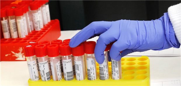 Labore sehen Entspannung im Infektionsgeschehen Weniger Tests mit positiven Befunden: „Die Entspannung ist real“, heißt es beim Berufsverband Deutscher Laborärzte.