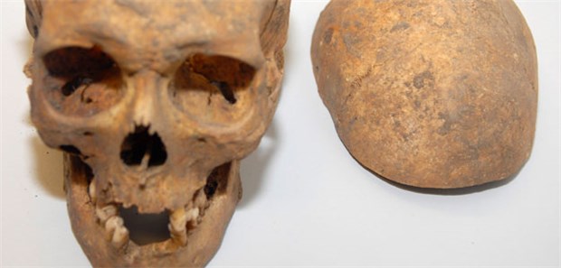 Ein Skelett für die Wissenschaft Wenn Knochen aus der Vergangenheit erzählen: Hier ein Schädel, der scheinbar von einem Laien geöffnet wurde. In Süddeutschland ist es nun erstmals gelungen, das Genom des Erregers der Justinianischen Pest vollständig zu rekonstruieren.