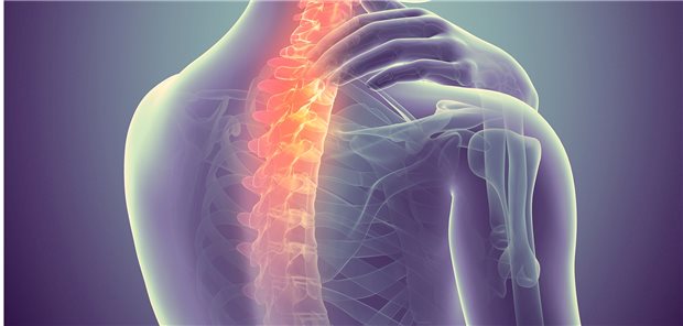 Migräne: Es kann auch an der Halswirbelsäule liegen! Wenn muskuloskelettale Funktionsstörungen vorliegen können Kopfschmerzen physiotherapeutisch beeinflusst werden.