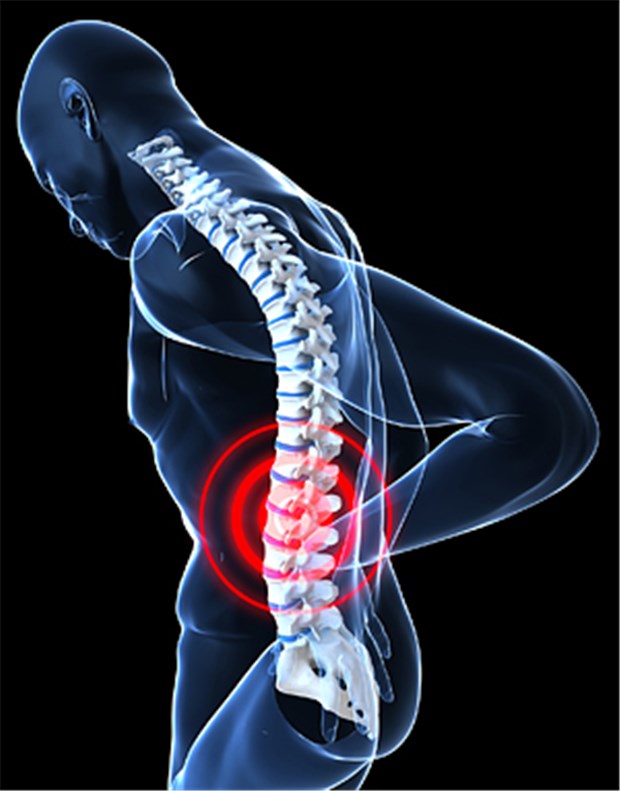Mit Neurostimulation anhaltende Besserung von Rückenschmerz Wenn nichts hilft gegen chronisch-rezidivierende Rückenschmerzen, kann eine Rückenmarkstimulation eine Option sein.