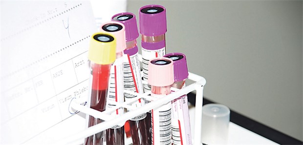 Wer Blutproben im Labor analysieren lässt, darf sie Privatpatienten nicht als Eigenleistung in Rechnung stellen.