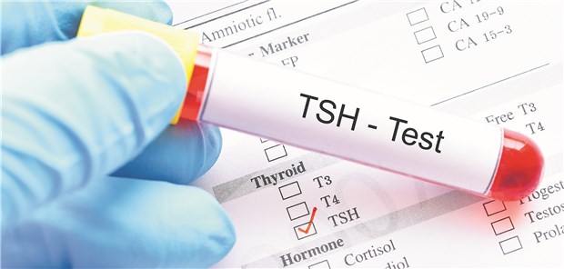 Wer ist für den TSH-Test zuständig? Da jeder Arzt versucht, sein Budget zu schonen, kommt es nicht nur bei dieser Laborleistung zu einem Gerangel um die Zuständigkeiten.