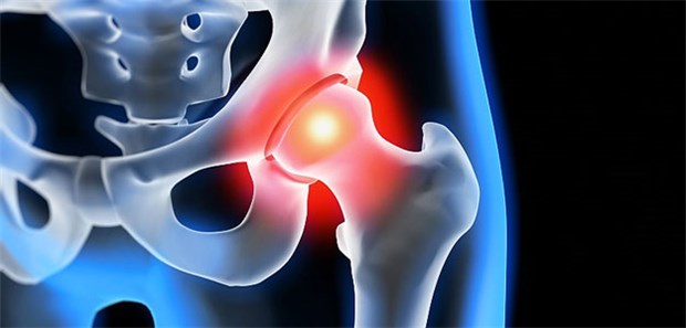 Nur wenige gute Internet-Videos für Patienten Wer sich zu seinen Arthrose-Beschwerden auf YouTube informieren will, sollte gezielt nach Qualität suchen.