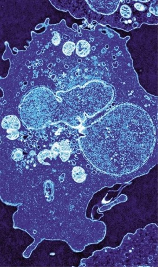Maßgeschneiderte T-Zellen sind ein Ansatz gegen Infektionen mit HIV Wichtiger Teil der Immunabwehr: blau gefärbte T-Zelle unter dem Elektronen-Mikroskop.