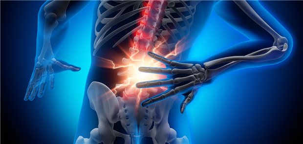 Wie Busra Sezer Kiral und Mitforschende betonen, war das Engpass-Syndrom häufig von weiteren Beschwerden begleitet, vor allem einer ipsilateralen Druckschmerzhaftigkeit im Lumbal- bzw. im Iliosakralbereich sowie im Bereich des M. piriformis.