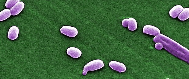 Milzbrand beunruhigt das RKI Wie auf einem Rasen: Sporen von Bacillus anthracis.