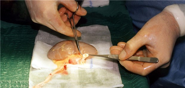 Abstoßungsprophylaxe mit Biomarkern Wie bei allen Spenderorganen besteht auch bei Nieren ein Abstoßungsrisiko durch den Empfänger.