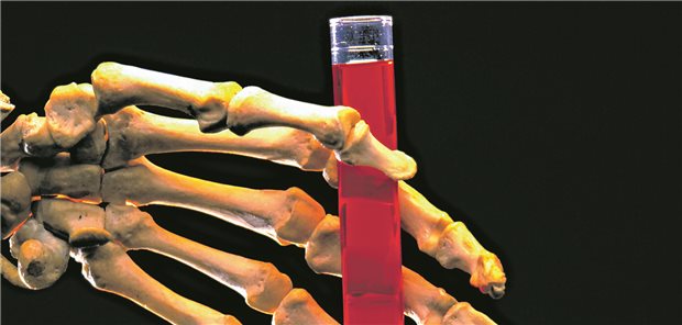 EU-Forschungsallianz knöpft sich Chemikalien-Risiken vor Wie gefährlich sind einzelne Chemikalien für Mensch, Tier und Umwelt? PARC soll es herausfinden.