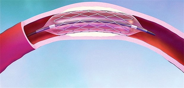 Das Dilemma der dualen Plättchenhemmung Wie lange KHK-Patienten nach Implantation eines Koronarstents duale Plättchenhemmung erhalten sollten, ist umstritten.