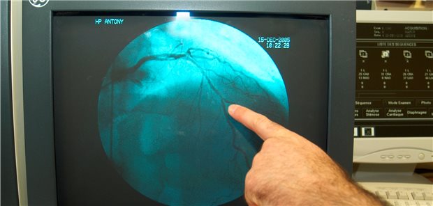 Wie lassen sich die Befunde der kardiologischen Diagnostik interpretieren, welche Konsequenzen sind zu ziehen?