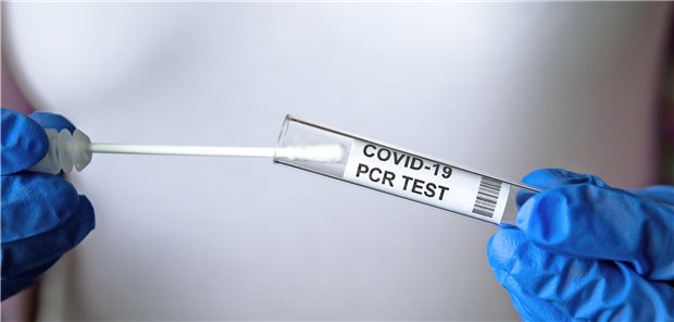 Wie viele PCR-Tests zum Nachweis einer SARS-CoV-2-Infektion sollen Labore künftig vorhalten? Sie wissen es nicht und sind deshalb auch nicht willig, groß zu investieren, wenn der Staat nicht die Richtung vorgibt und finanzielle Unterstützung zusagt.