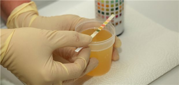 Wiederkehrende Harnwegsinfektionen betreffen 10 bis 15 Prozent aller Frauen über 60 und fast 50 Prozent aller Patientinnen mit dem „Genitourinary Syndrome of Menopause“.