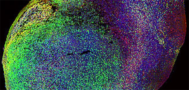 Künstliches Gehirn mit Rückgrat Wiener Forscher haben Organoide weiterentwickelt, so dass sie sich an ein Polymer-Gerüst anlagern.