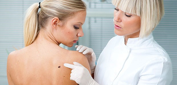 Hautkrebs kommt selten allein Wird Hautkrebs bei einem Patienten gefunden, der noch keine 40 Jahre alt ist, hat dieser nach Angaben der kanadischen Forscher ein fünfeinhalbfaches Risiko für einen Zweittumor.
