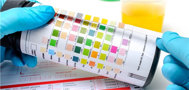 Wird der Urinstreifentest bei Verdacht auf Harnwegsinfekt bald abgelöst? Ein einfaches Point-of-Care-Testsystem kann Bakterienlast und Resistenz nachweisen und so genaue Diagnostik ermöglichen.