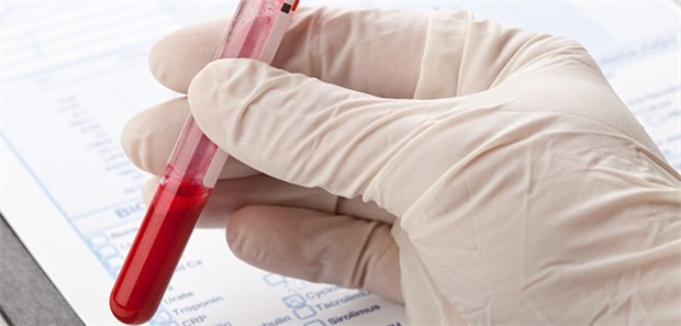 Wird hscTn künftig bestimmt?