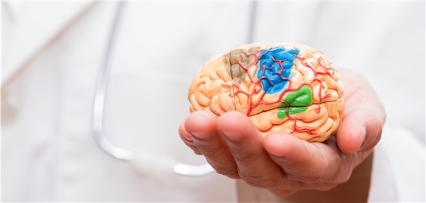 Wissenschaftler haben die wichtigsten Erkenntnisse zum Schlaganfall während der International Stroke Conference zusammengetragen.