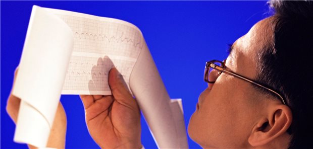 Woher kommt das Vorhofflimmern? Es könnte am Alkoholkonsum des Patienten liegen: Alkohol erzeugt einer Studie zufolge elektrophysiologische Effekte, die womöglich den Vorhof anfälliger für Arrhythmien machen.