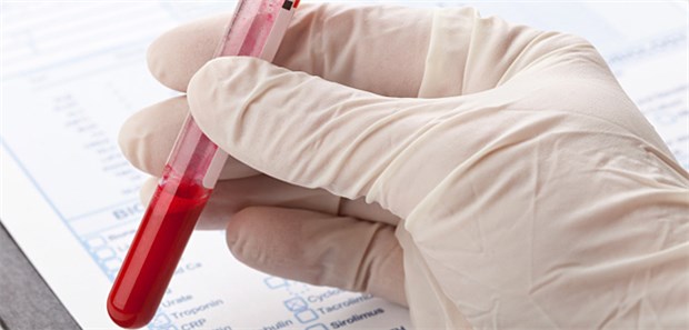 Womit werden die HbA1c-Werte bestimmt? Bei einigen Messverfahren können Hämoglobinvarianten das Ergebnis stark verfälschen.